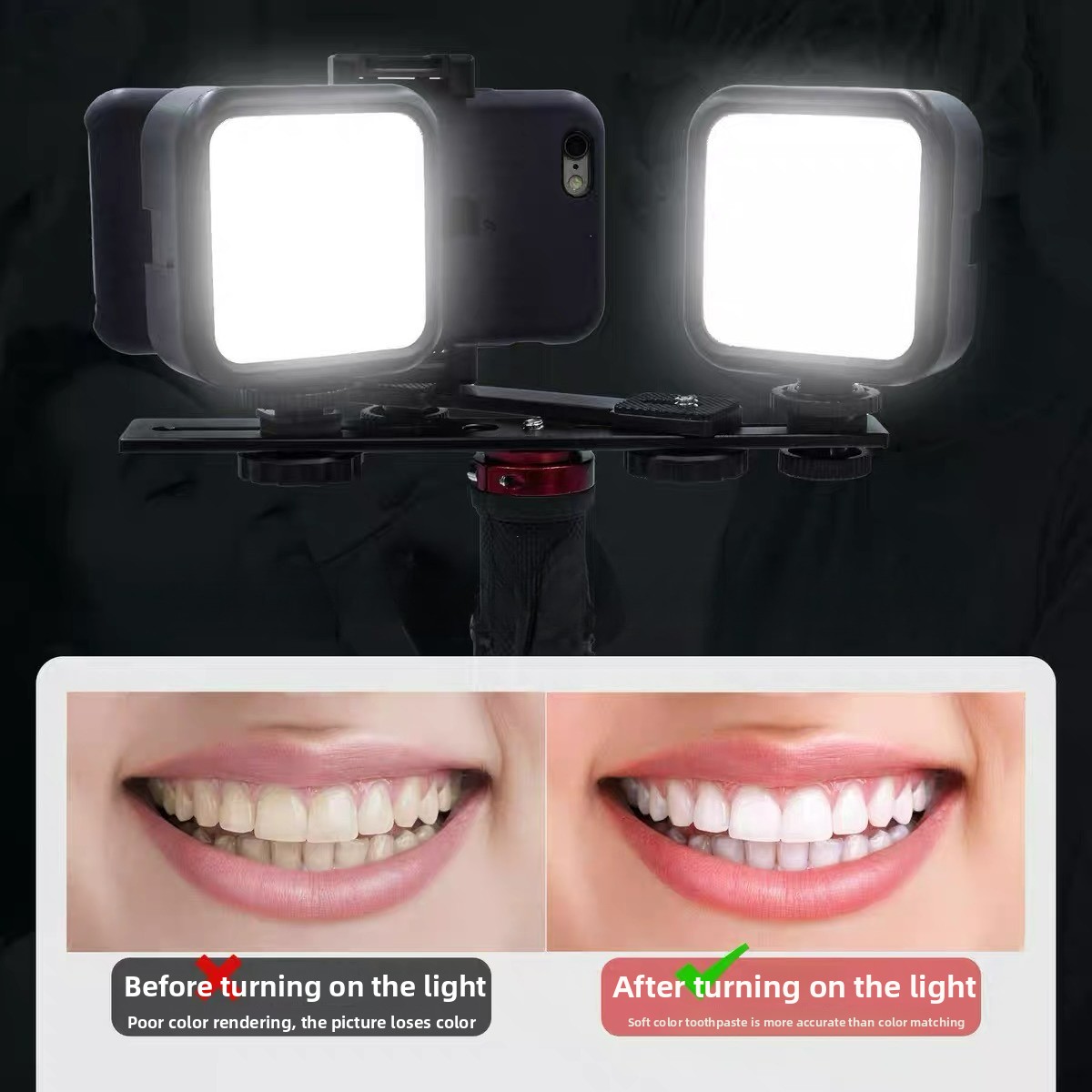 Photography Lighting Basics - Bluetooth搭載歯科用写真撮影ライト 口腔内写真照明 LED懐中電灯 腔内検査治療用モバイルランプ 充填ビデオ
